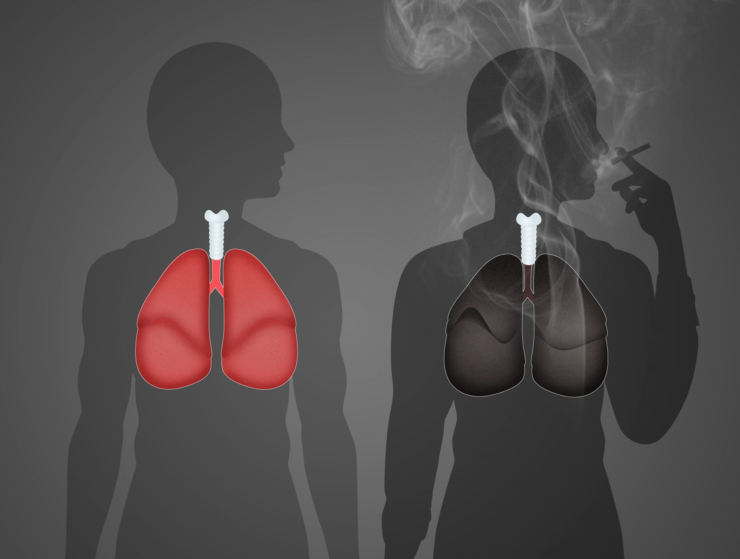 onhandig Bereiken slagader Herstel van de longen - Medipro | Stoppen met Roken Coaching